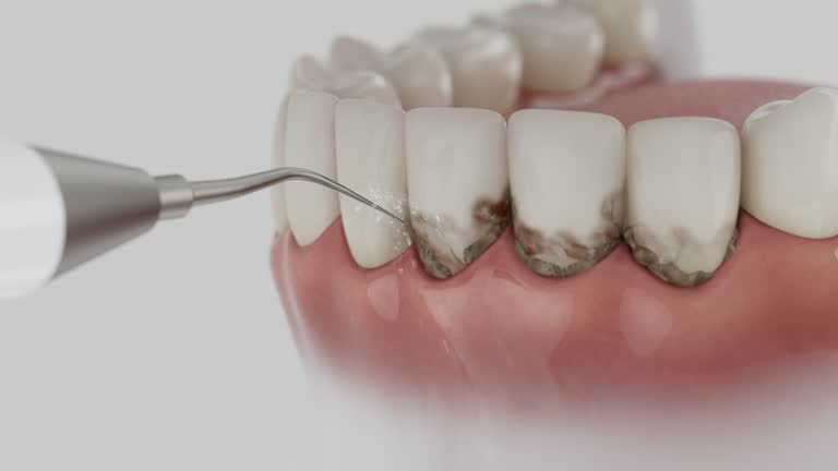 Reliable Dental Crowns And Bridges contractor in Towner County County, ND by Dentist Open Now